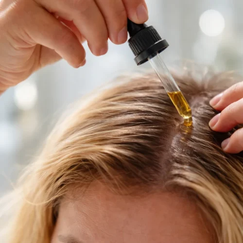 Bottle of onion juice for thinning hair treatment and hair growth solution